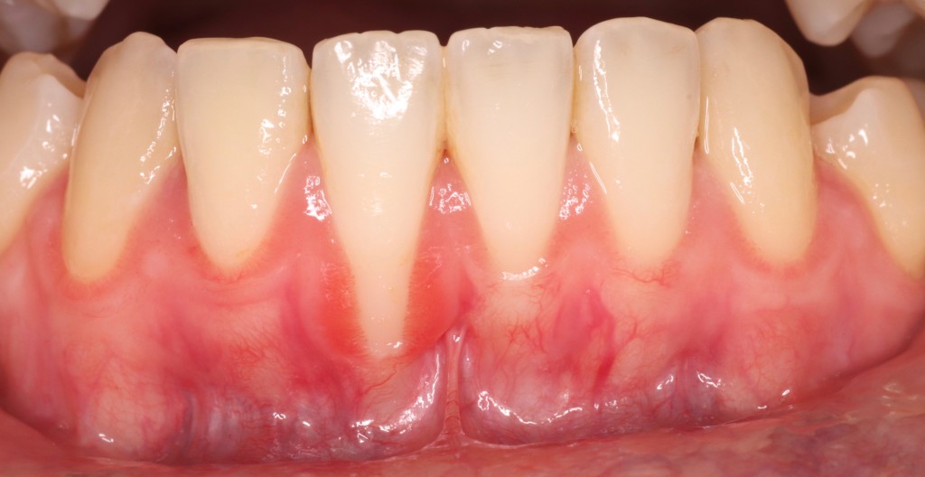 Tratamientos dentales en La Línea de La Concepción - Clínica Dental Centro