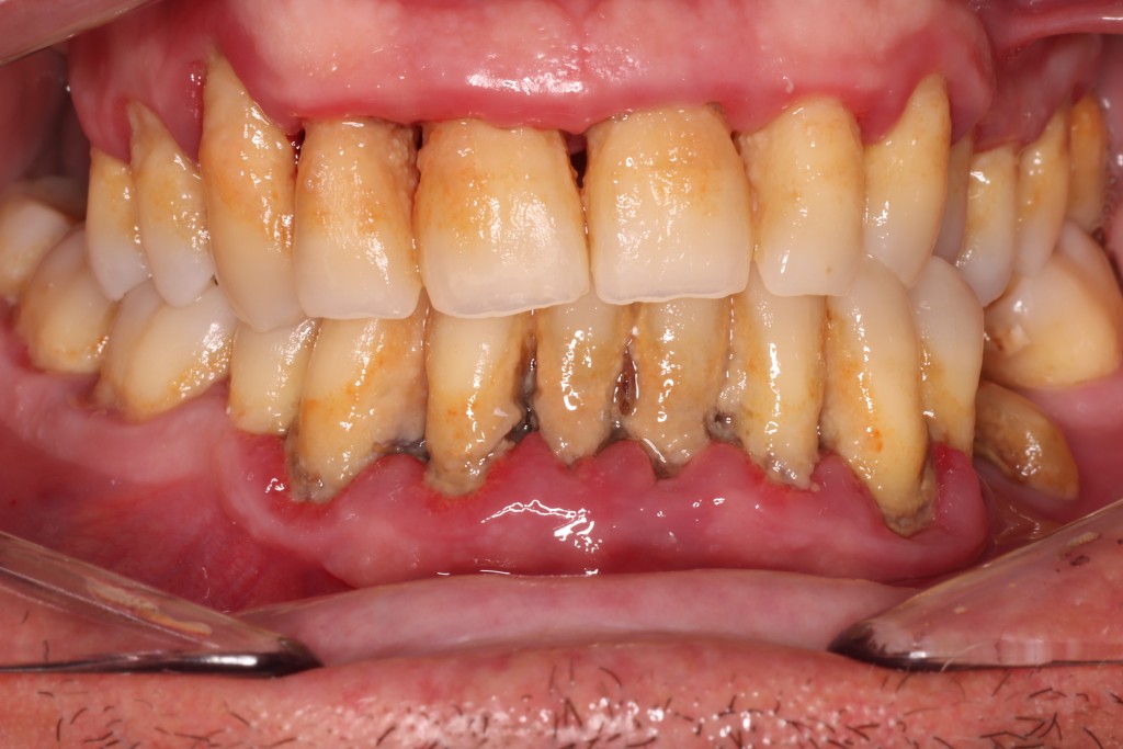 Tratamientos dentales en La Línea de La Concepción - Clínica Dental Centro