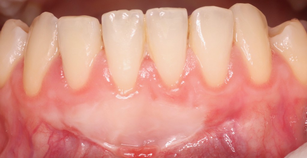 Tratamientos dentales en La Línea de La Concepción - Clínica Dental Centro