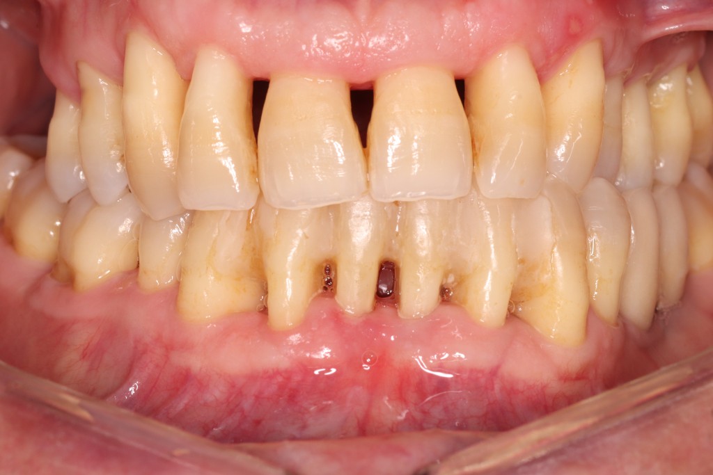 Tratamientos dentales en La Línea de La Concepción - Clínica Dental Centro