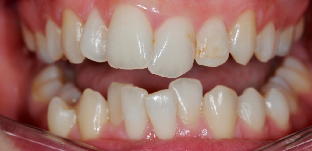 Tratamientos dentales en La Línea de La Concepción - Clínica Dental Centro