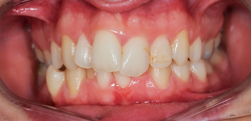 Tratamientos dentales en La Línea de La Concepción - Clínica Dental Centro