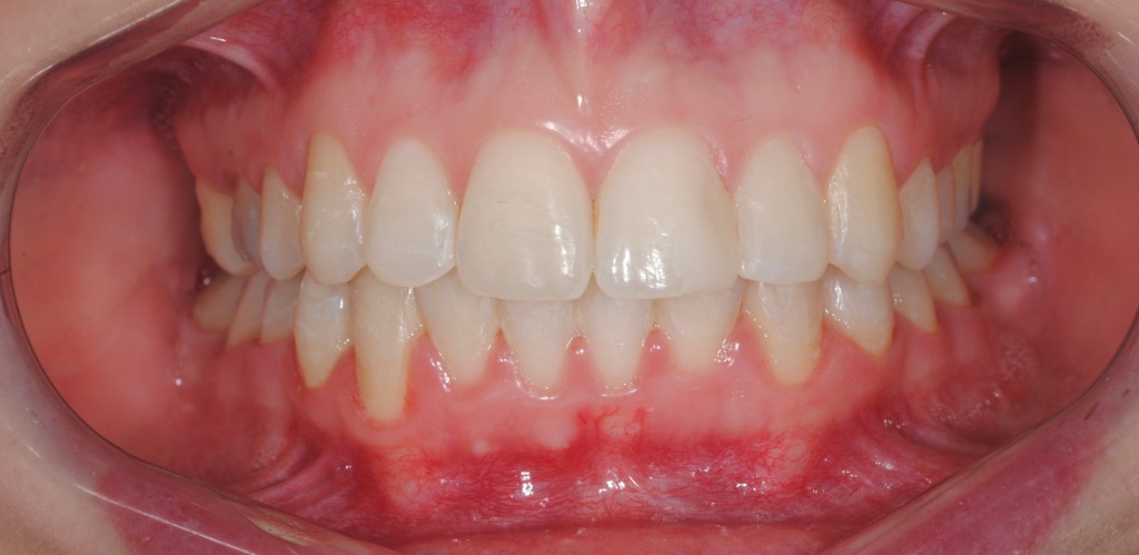 Tratamientos dentales en La Línea de La Concepción - Clínica Dental Centro