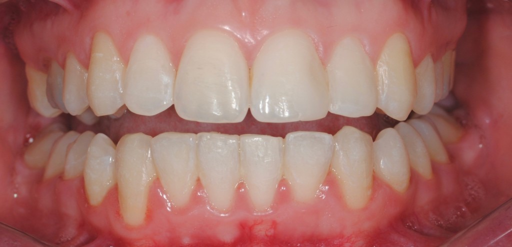 Tratamientos dentales en La Línea de La Concepción - Clínica Dental Centro