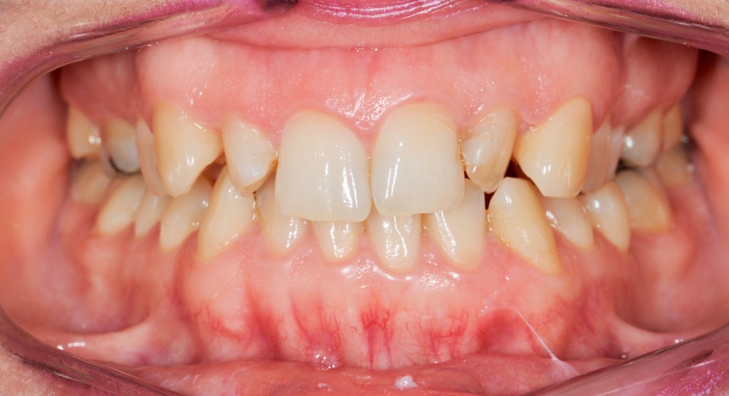 Tratamientos dentales en La Línea de La Concepción - Clínica Dental Centro