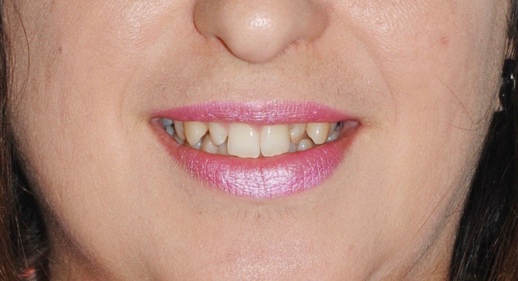 Tratamientos dentales en La Línea de La Concepción - Clínica Dental Centro