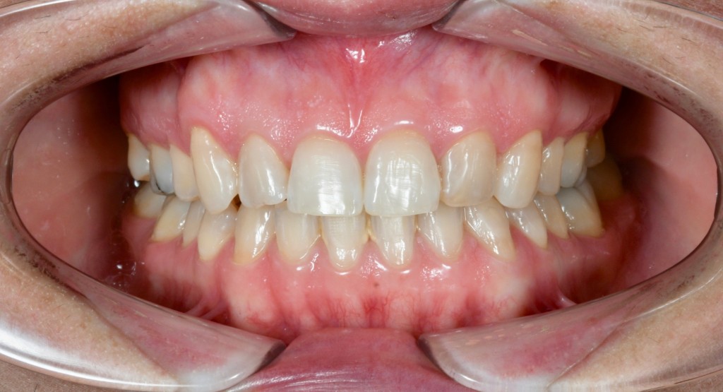 Tratamientos dentales en La Línea de La Concepción - Clínica Dental Centro