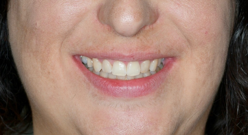 Tratamientos dentales en La Línea de La Concepción - Clínica Dental Centro