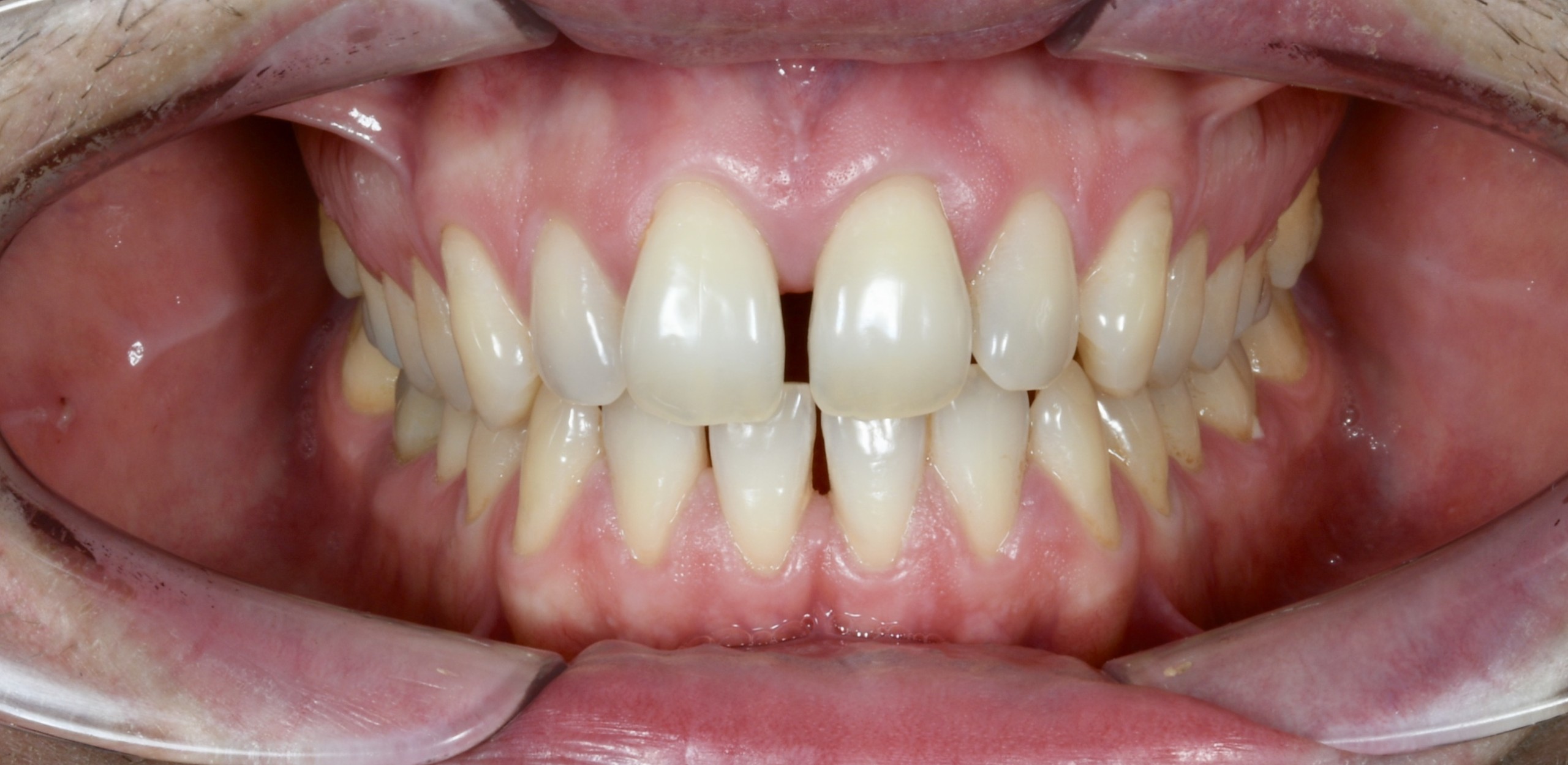 Tratamientos dentales en La Línea de La Concepción - Clínica Dental Centro