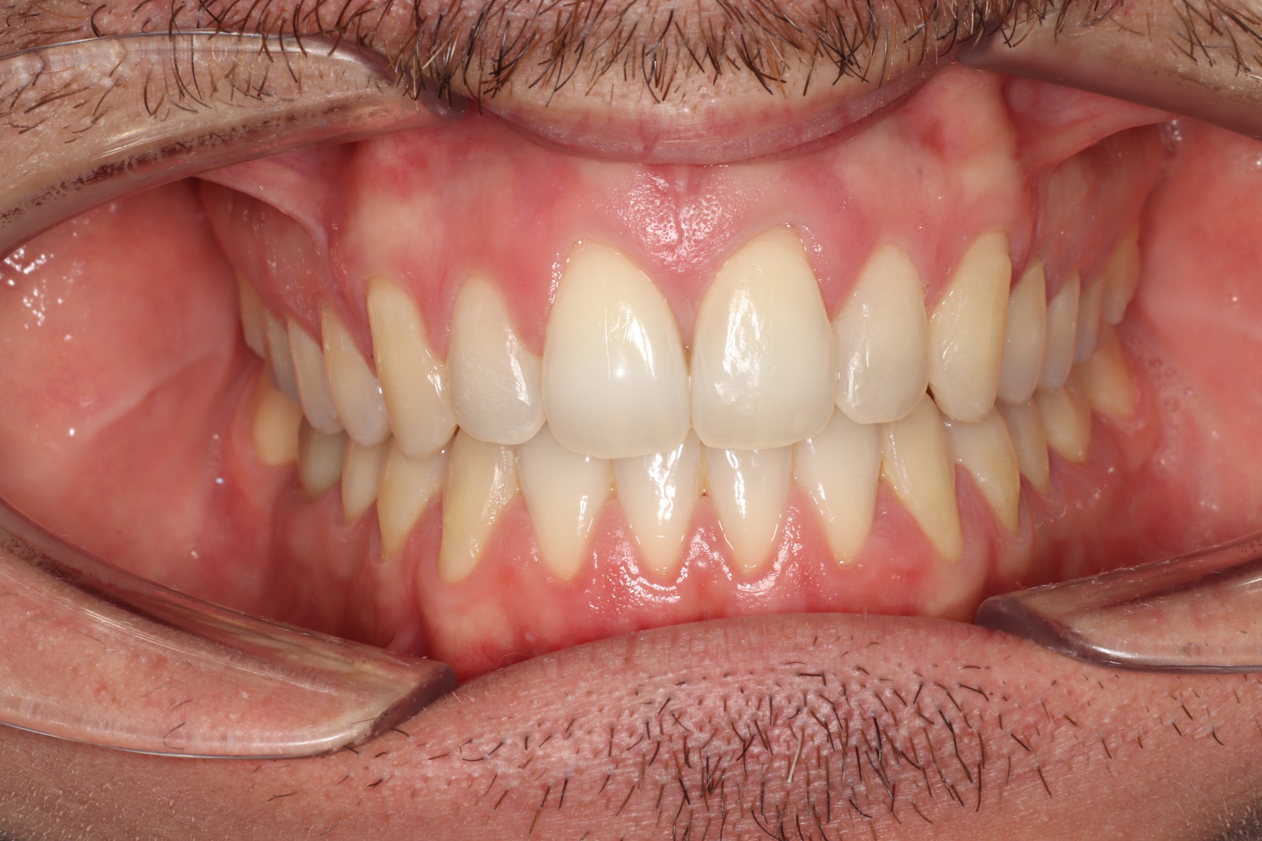 Tratamientos dentales en La Línea de La Concepción - Clínica Dental Centro