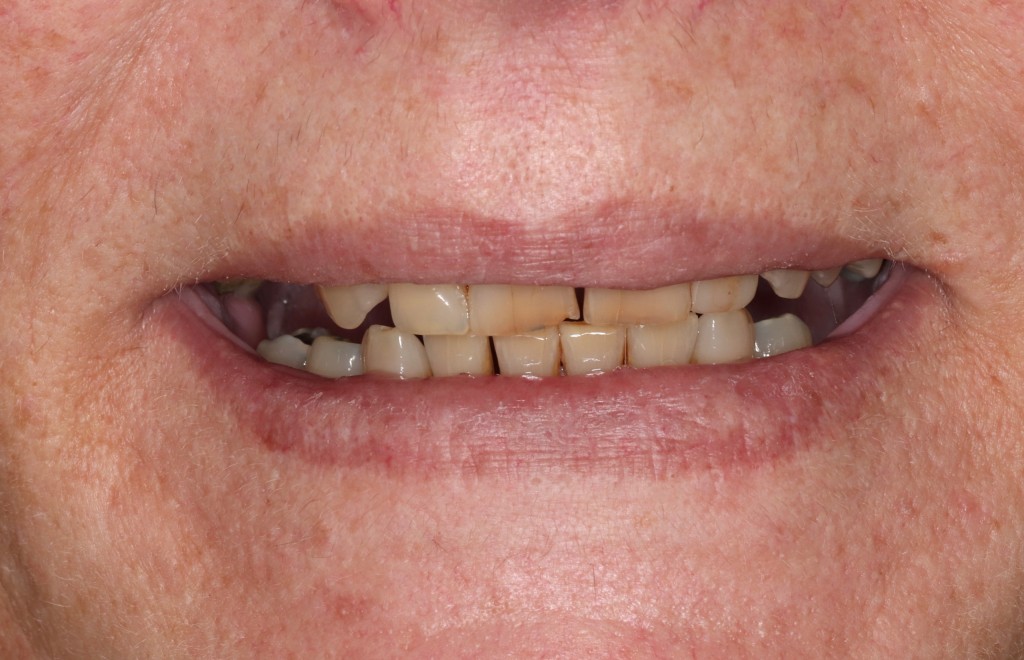 Tratamientos dentales en La Línea de La Concepción - Clinica Dental Centro