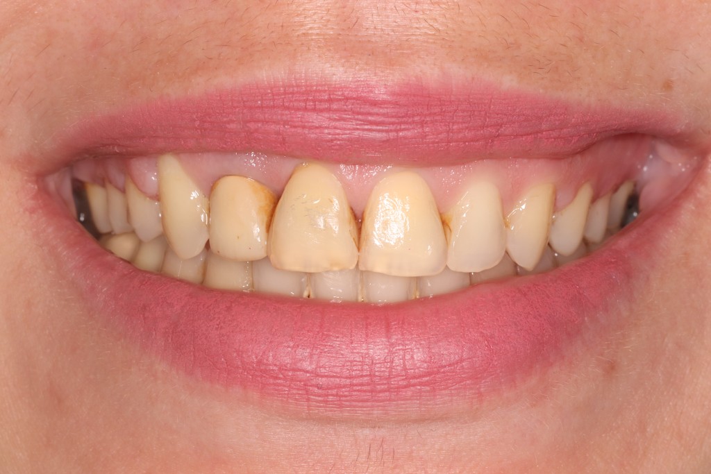 Tratamientos dentales en La Línea de La Concepción - Clinica Dental Centro