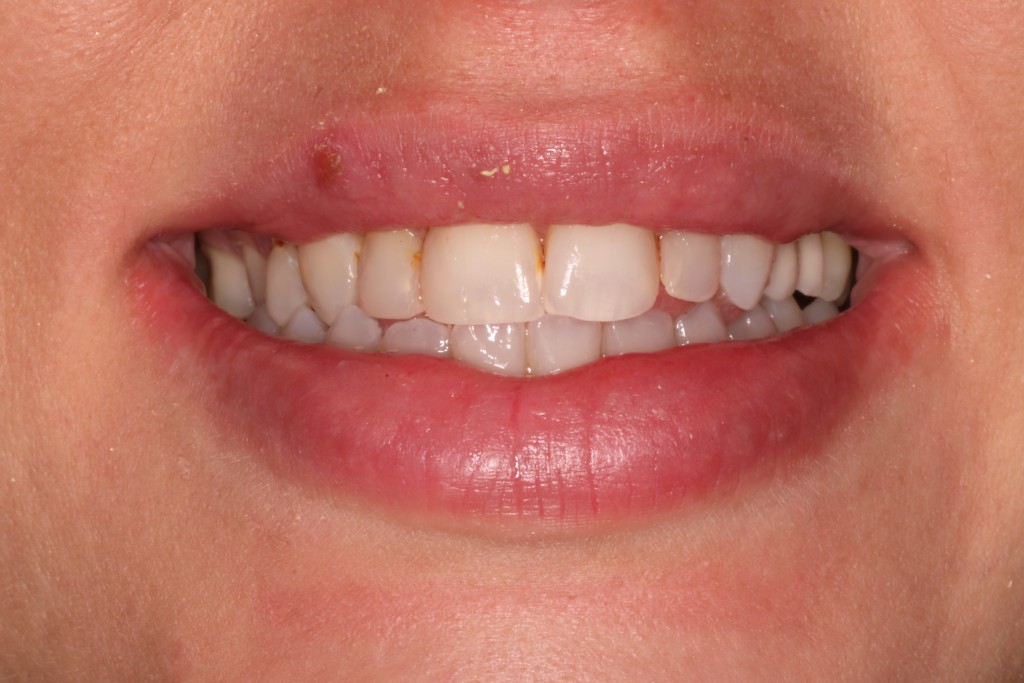 Tratamientos dentales en La Línea de La Concepción - Clinica Dental Centro