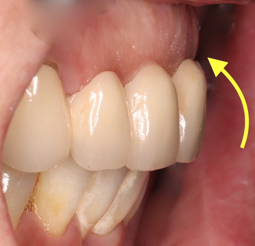 Tratamientos dentales en La Línea de La Concepción - Clinica Dental Centro