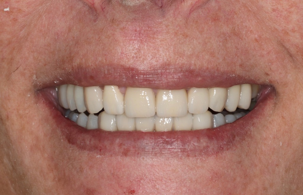 Tratamientos dentales en La Línea de La Concepción - Clinica Dental Centro