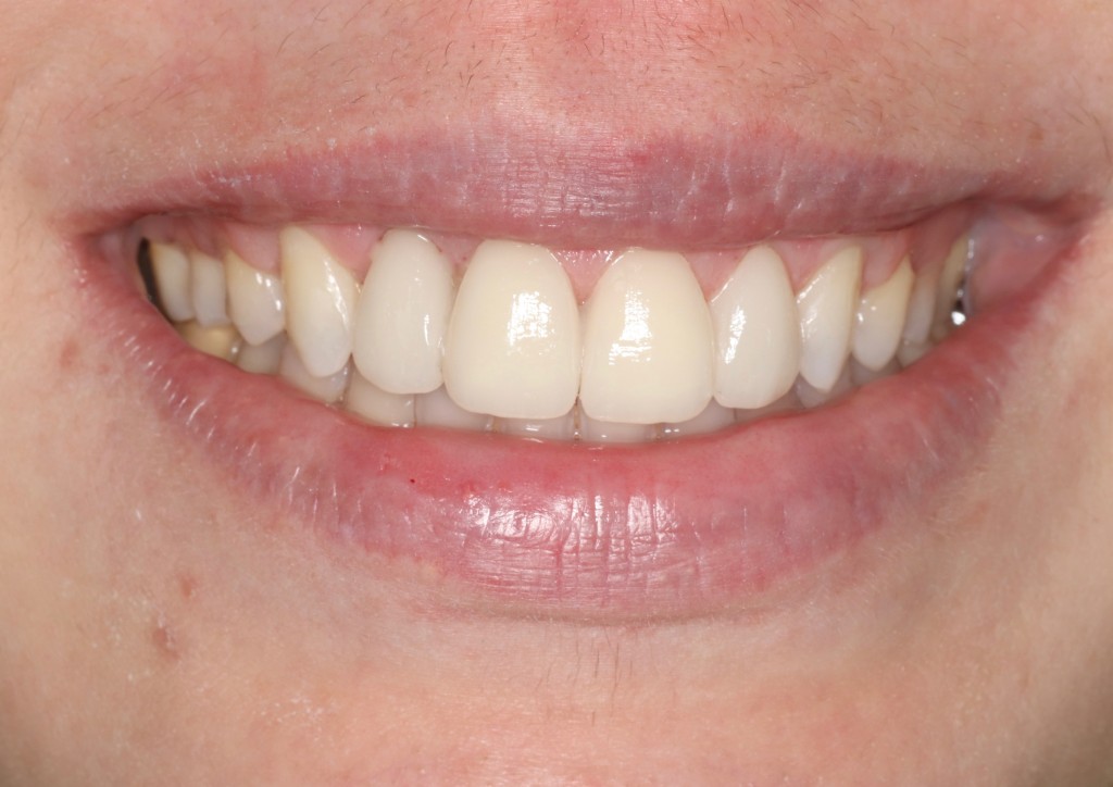 Tratamientos dentales en La Línea de La Concepción - Clinica Dental Centro