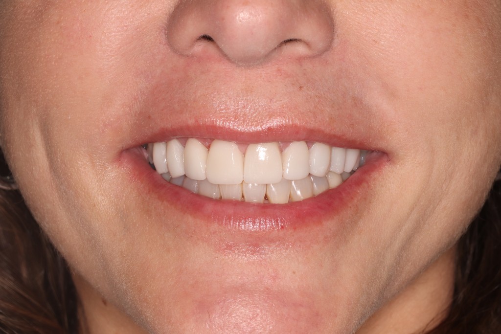 Tratamientos dentales en La Línea de La Concepción - Clinica Dental Centro