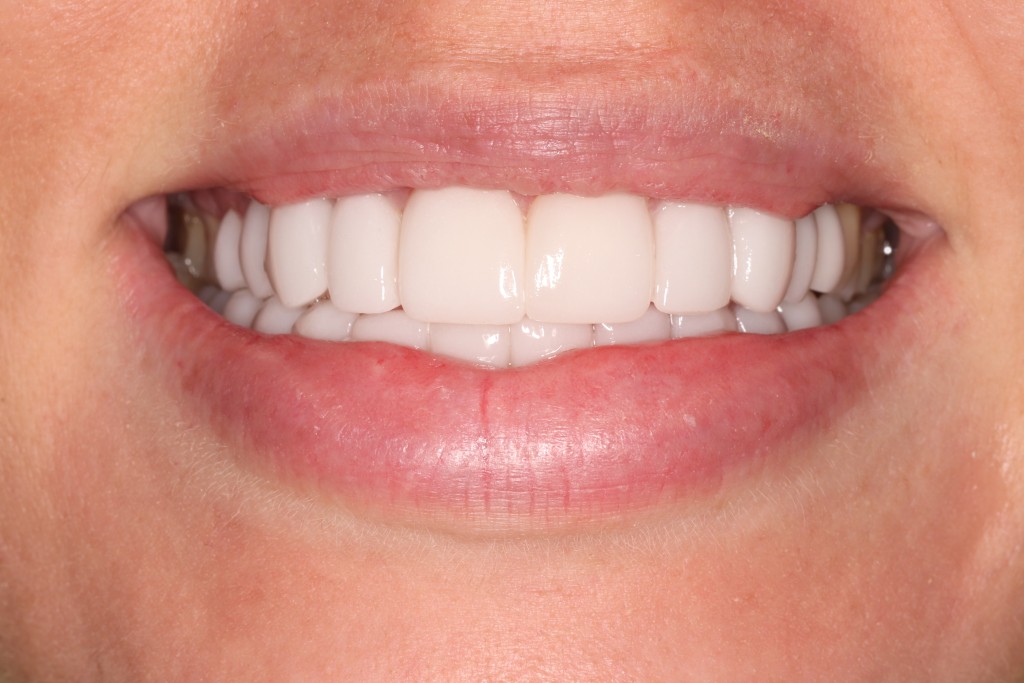 Tratamientos dentales en La Línea de La Concepción - Clinica Dental Centro