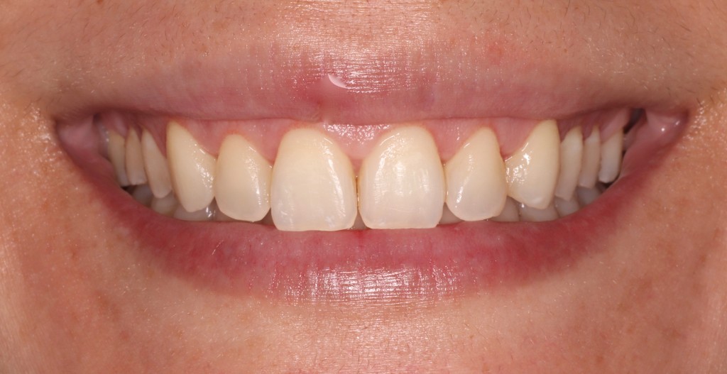 Tratamientos dentales en La Línea de La Concepción - Clinica Dental Centro