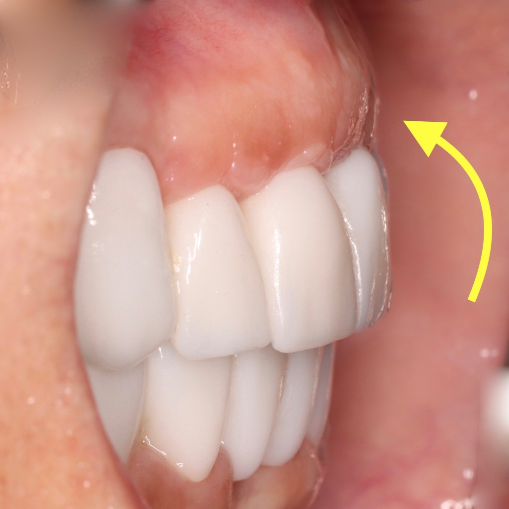 Tratamientos dentales en La Línea de La Concepción - Clinica Dental Centro