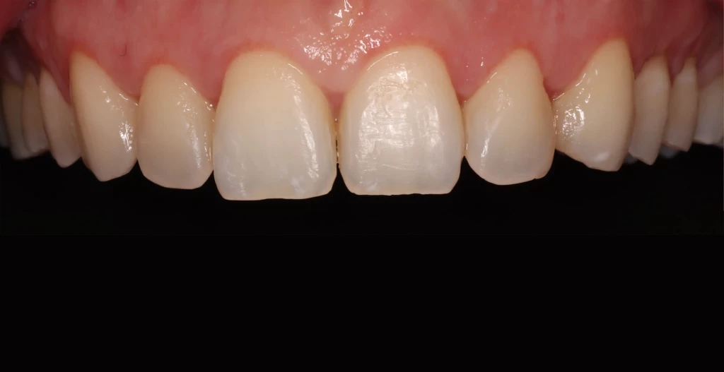 Tratamientos dentales en La Línea de La Concepción - Clinica Dental Centro