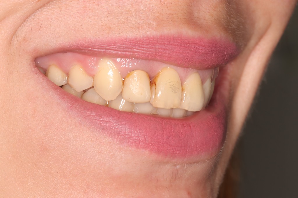 Tratamientos dentales en La Línea de La Concepción - Clinica Dental Centro