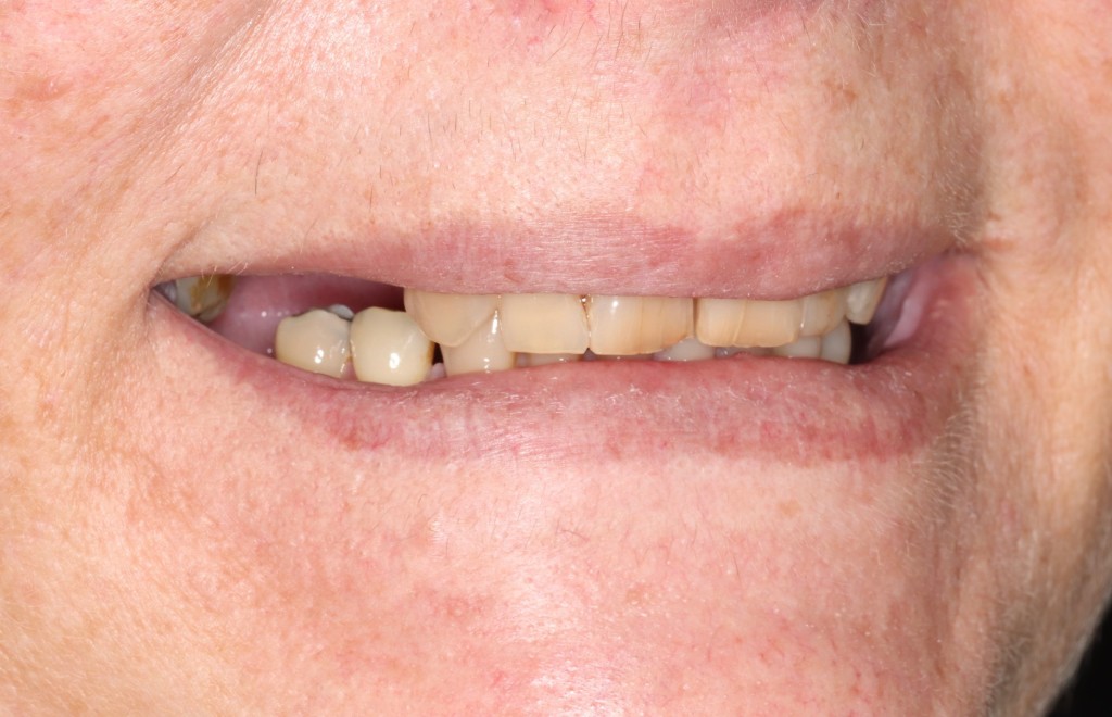 Tratamientos dentales en La Línea de La Concepción - Clinica Dental Centro