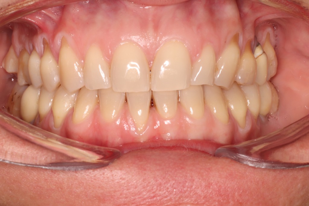 Tratamientos dentales en La Línea de La Concepción - Clinica Dental Centro