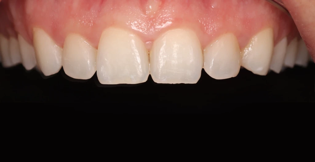 Tratamientos dentales en La Línea de La Concepción - Clinica Dental Centro