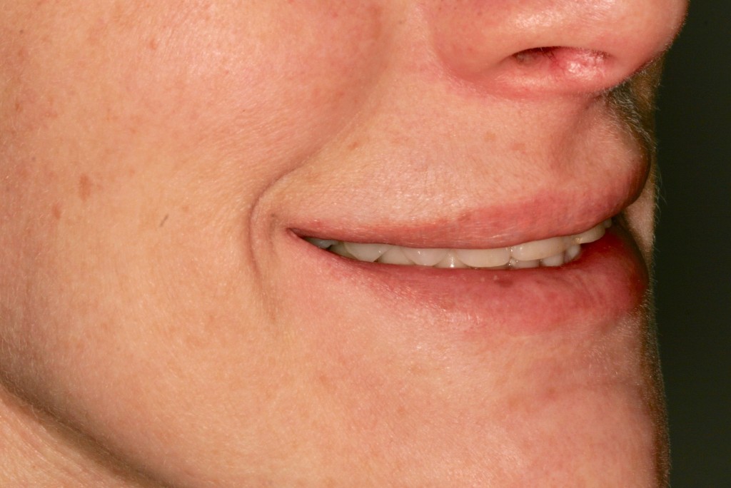 Tratamientos dentales en La Línea de La Concepción - Clinica Dental Centro