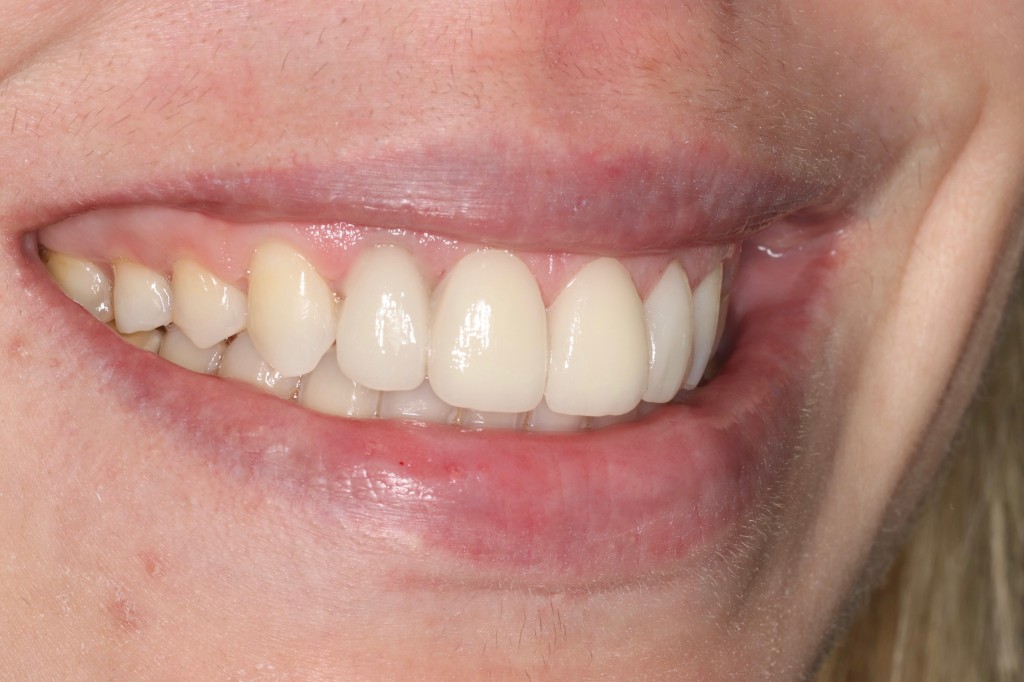 Tratamientos dentales en La Línea de La Concepción - Clinica Dental Centro