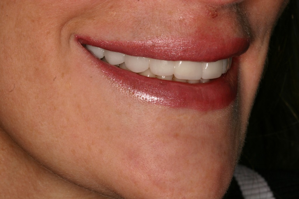 Tratamientos dentales en La Línea de La Concepción - Clinica Dental Centro