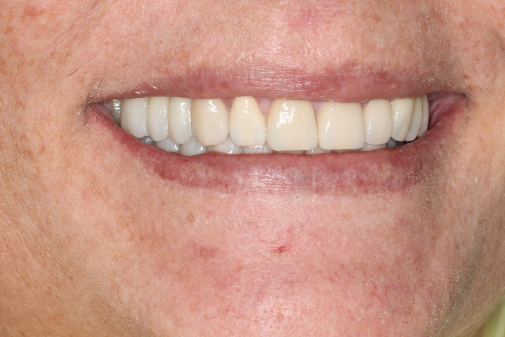 Tratamientos dentales en La Línea de La Concepción - Clinica Dental Centro