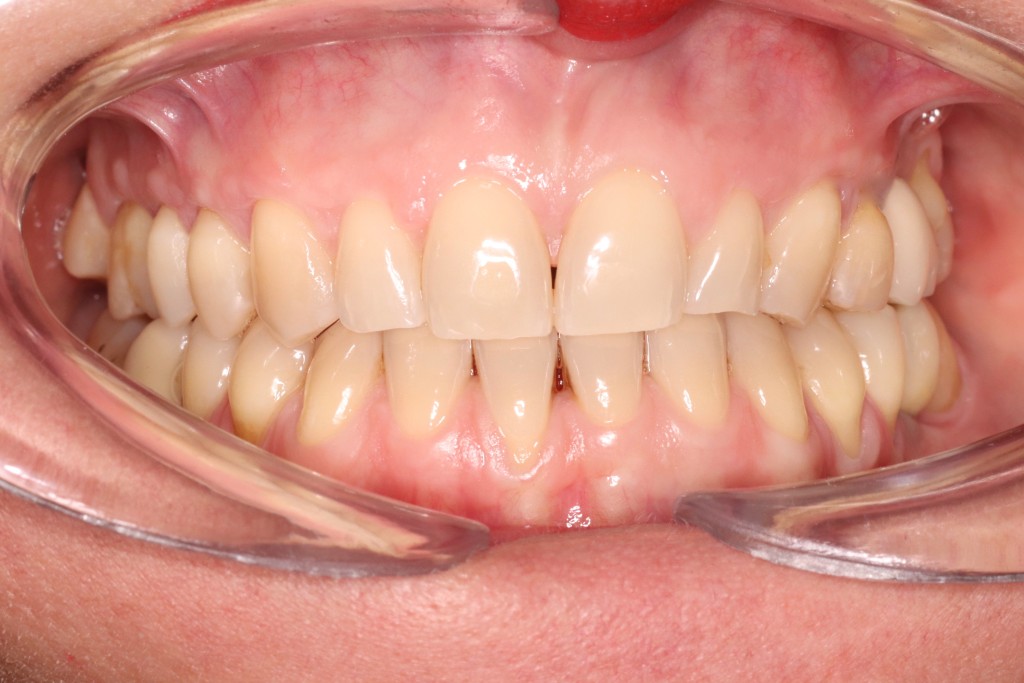 Tratamientos dentales en La Línea de La Concepción - Clinica Dental Centro