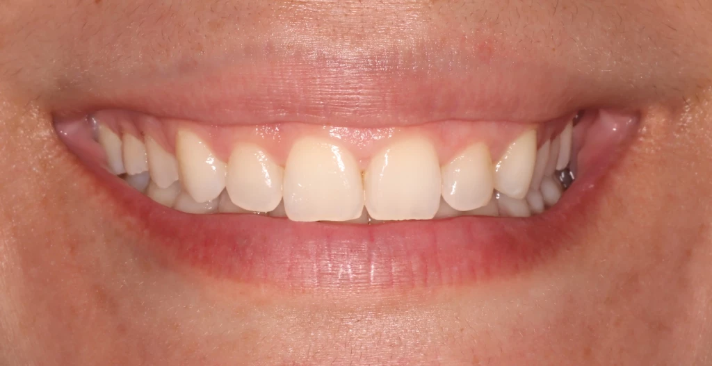 Tratamientos dentales en La Línea de La Concepción - Clinica Dental Centro