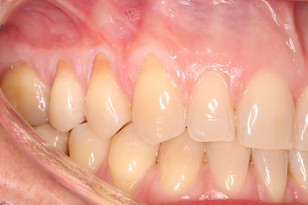 Tratamientos dentales en La Línea de La Concepción - Clinica Dental Centro
