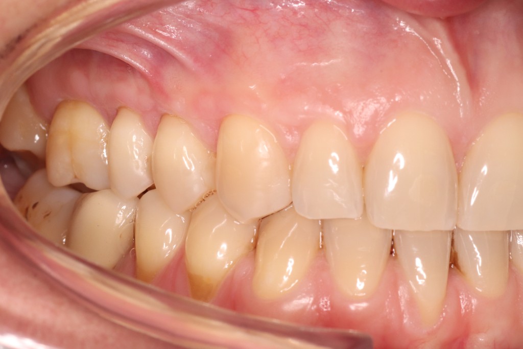 Tratamientos dentales en La Línea de La Concepción - Clinica Dental Centro