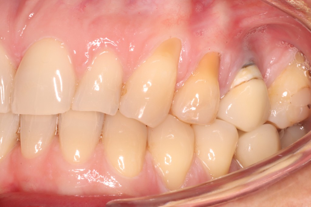 Tratamientos dentales en La Línea de La Concepción - Clinica Dental Centro