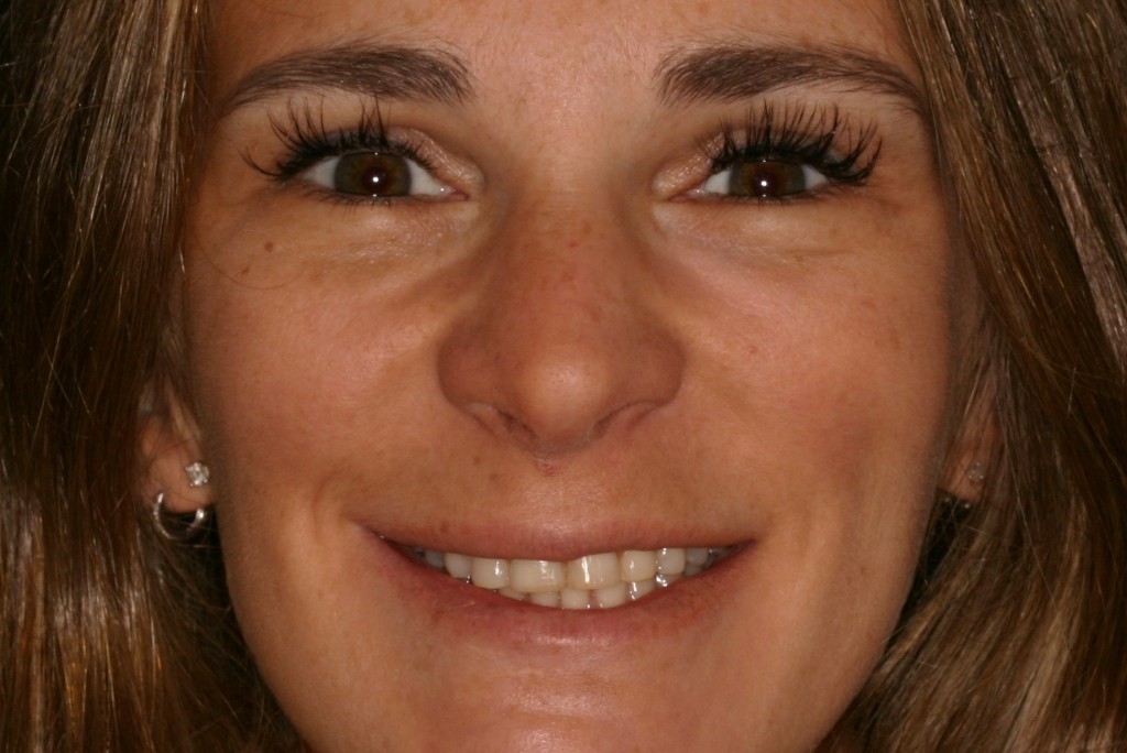 Tratamientos dentales en La Línea de La Concepción - Clinica Dental Centro