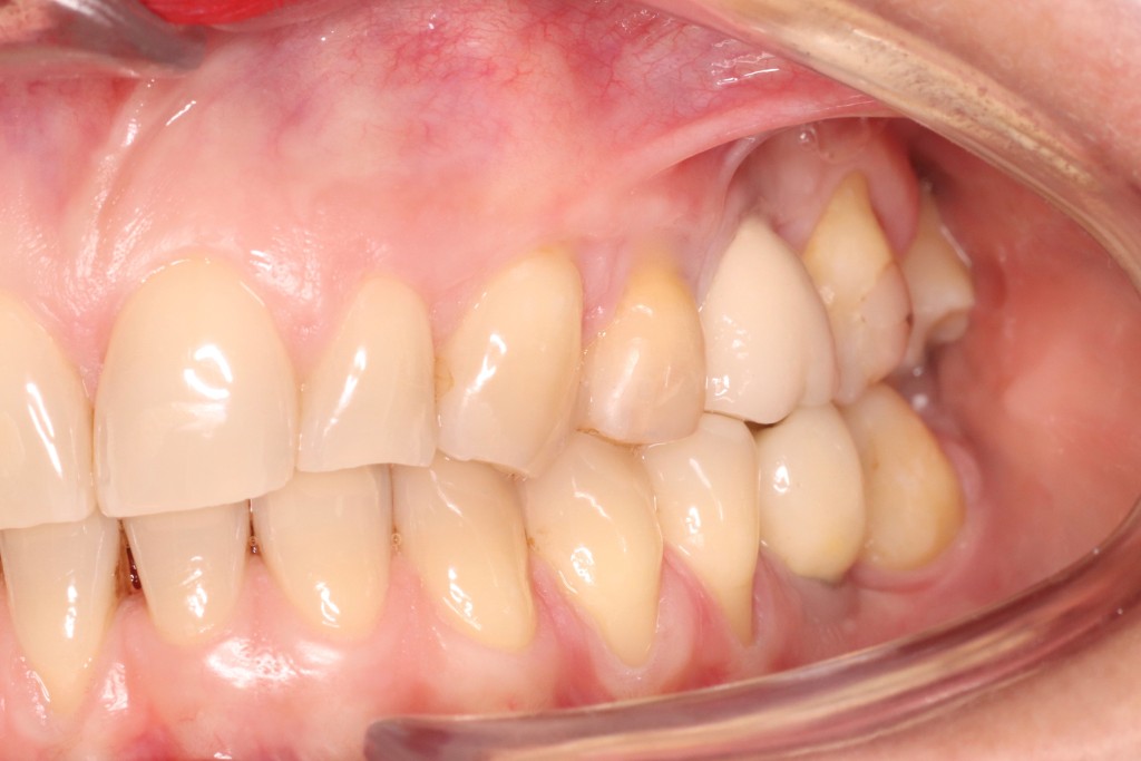 Tratamientos dentales en La Línea de La Concepción - Clinica Dental Centro