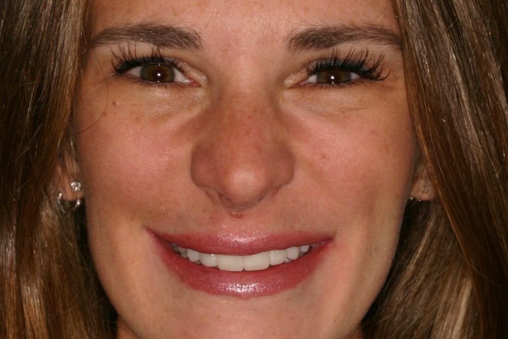 Tratamientos dentales en La Línea de La Concepción - Clinica Dental Centro