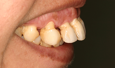 Tratamientos dentales en La Línea de La Concepción - Clinica Dental Centro