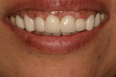 Tratamientos dentales en La Línea de La Concepción - Clinica Dental Centro