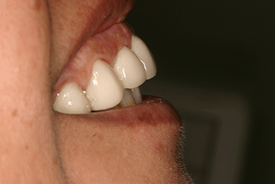 Tratamientos dentales en La Línea de La Concepción - Clinica Dental Centro